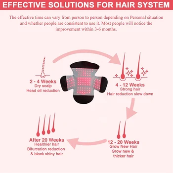LLLT Terapija, plaukų slinkimas gydymo 650nm 100 diodų LED šalmas plaukai atauga